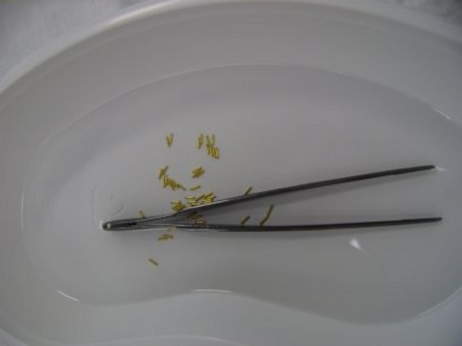 Nierbekkentje met pincet en gouden markerstaafjes. Vier ervan worden rond mijn prostaat geplaatst