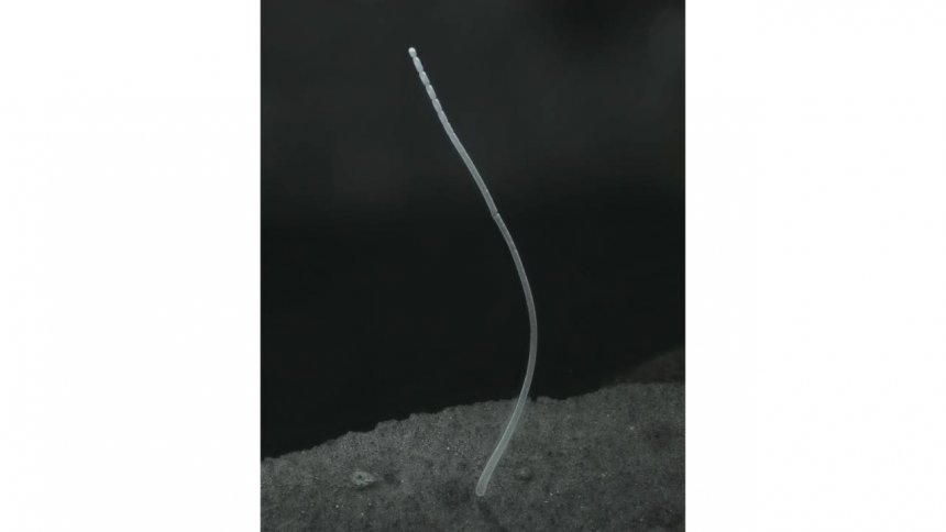 De bacterie Thiomargarita Magnificans.